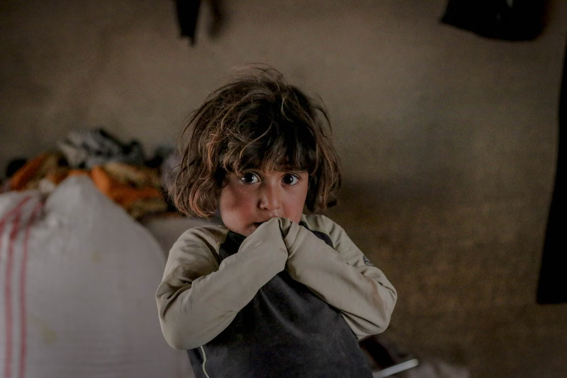 Documentary Portrait Of Childhood Resilience Indoors A malnurished girl in a living room